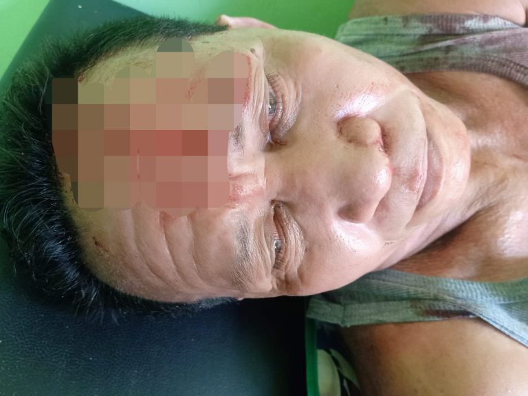 Kepsek SD GMIH Dorume Jadi Korban Penganiayaan